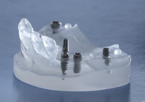 Demed Płock implanty zębow